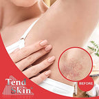 Tend Skin The Skin Care Solution For Unsightly Razor Bumps, Ingrown Hair And Razor Burns, 8 Fl Oz Bottle