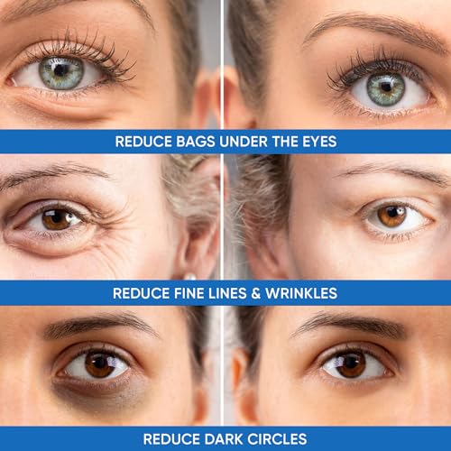 Under Eye Puffiness & Dark Circles Rapid Treatment- Instantly Reduces the Appearance of Puffy Eye Bags, Crow’s Feet, & Sagging Skin.