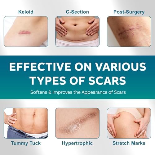 Silicone Scar Sheets, Silicone Scar Tape(1.6"x 120" Roll-300CM), Silicone Tape for Scars, Scar Tape for Surgical Scars, Silicone Scar Strips for C-Section, Tummy Tuck, Keloid, and Surgical Scars