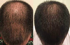 Zenagen Revolve Thickening Hair Loss Treatment for Men