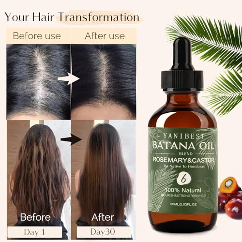 YANIBEST Batana Castor Oil, 100% Pure Natural Hair Oil for Strengthening Hair, Nourish and Repair Damaged Hair, Improve Scalp Health