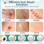 Losveo Silicone Scar Sheets for Face Wrinkles, Medical Grade Silicone Scar Sheets(1.6”x 120” Roll-3M) for Surgical Scars, C-Section, Burn, and Acne Scars- Reusable Scar Removal Strips