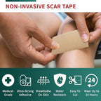 Medical-Grade Silicone Scar Tape Roll (1.6" x 118") Keloid Bump Removal Scar Sheets - Reusable Silicone Tape Scar Removal Strips, Scar Tape for Surgical Scars, C Section Scar Silicone Strips (2 Pack)