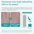 Dimora Medical Grade Silicone Scar Sheets - Ultra Soft Silicone Scar Tape (1.6”x120" Roll), Waterproof Scar Treatment for Surgical Scars, C Section, Tummy Tuck, Keloid Treatment