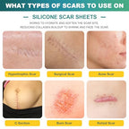 Silicone Scar Sheets (1.6" x 120" Roll-3M), Silicone Scar Tape for Scar Removal Treatment, Silicone Scar Removal Strips for Surgical, C-Section, Tummy Tuck, Keloid Bump Removal