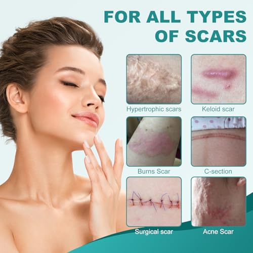 Silicone Scar Sheets, Silicone Scar Tape(1.6"x 79"), Professional Scar Removal Treatment, Reusable Silicone Scar Strips for Keloids, Surgeries Scars, C-sections, and Burns