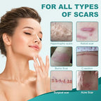 Silicone Scar Sheets, Silicone Scar Tape(1.6"x 79"), Professional Scar Removal Treatment, Reusable Silicone Scar Strips for Keloids, Surgeries Scars, C-sections, and Burns