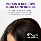 Head & Shoulders Scalp X 2% Minoxidil for Women, Hair Regrowth Treatment for Thinning Hair and Hair Loss, Topical Solution, 3 Month Supply, 2 Fl Oz Each, Pack of 3