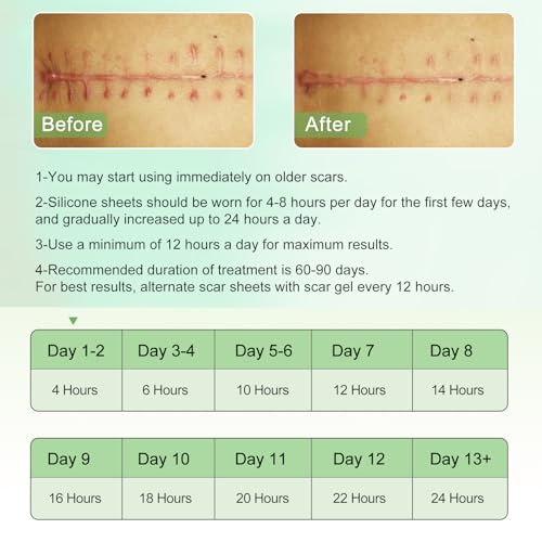 Silicone Scar Sheets, Clear Silicon Gel Scar Sheets, Invisible Scar Tape(1.6” x 120”Roll-3M), Scar Strips for Surgical Scars, Medical Grade, Scar Removal Sheets for C-Section, Breast, Keloid et.