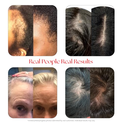 HAIRtamin Scalp Serum Natural Hair Growth Thickening Treatment | Visibly Increases Thicker Looking Hair and Promotes Scalp Health | Nourishes & Hydrates Dry, Itchy Scalp (1)