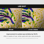 Medicube Age-R Line Shot - A Start of Effective Fine Lines Care Device for Smoothing Wrinkles Around Eyes, Lips, 11s, Neck, Plump Lips - Daily Anti-Aging Treament - Korean Skin Care