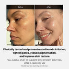 medicube Triple Collagen Cream - Hydrating & Firming Moisturizer with Hyaluronic Acid, Premium Elastin, Shea Butter - Wrinkle Care & Boosts Elasticity - Korean Skincare, 1.69 oz