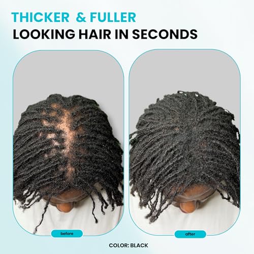 SURETHIK Hair Fibers, 15g (Black), Fills Thinning Hair for Visibly Fuller Look, Conceals Bald Spots, Natural Look, For Men & Women