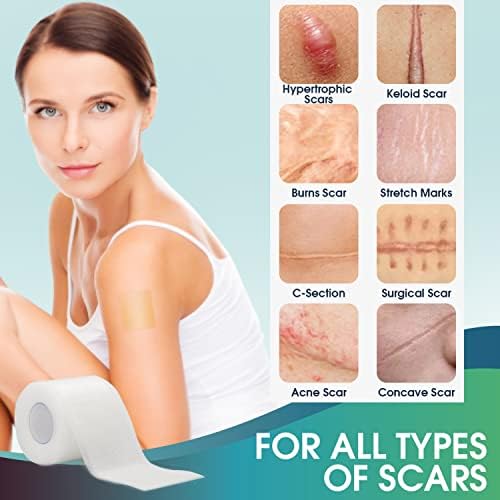 Silicone Scar Sheets (1.6" x 120") Clear Silicone Scar Tape - Scars Removal Treatment - Reusable Scar Strips for Keloid, C-Section, Burn, Surgical Scars