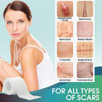 Silicone Scar Sheets (1.6" x 120") Clear Silicone Scar Tape - Scars Removal Treatment - Reusable Scar Strips for Keloid, C-Section, Burn, Surgical Scars