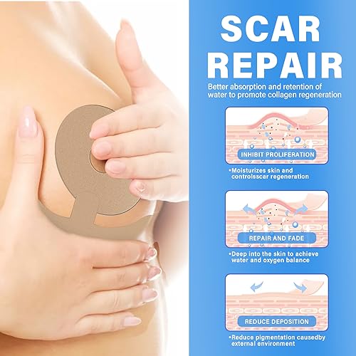 Silicone Scar Sheets, Silicone Scar Tape, Medical Grade Scar Removal Strips，Reusable and Effective Breast Silicone Scar Sheets, 4 Pair/Blue