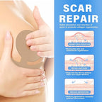 Silicone Scar Sheets, Silicone Scar Tape, Medical Grade Scar Removal Strips，Reusable and Effective Breast Silicone Scar Sheets, 4 Pair/Blue
