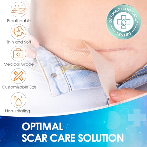Silicone Scar Sheets (1.6" X 120" Roll), Medical Grade Silicone Scar Tape, Soft Silicone Scar Patches for Surgical Scars, C Section, Keloid, Tummy Tuck, Burn