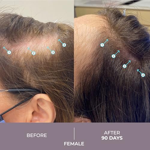 DS Laboratories Spectral.CSF Biotin Hair Serum - Regrowth and Thickening Treatment for Thinning Hair in Women