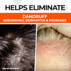Medicasp Coal Tar Gel Anti Dandruff Shampoo, Treats Seborrheic Dermatitis & Psoriasis, Formulated for Dry, Flaky & Itchy Scalp Treatment, for Women & Men, 6 Ounce (Pack of 2)