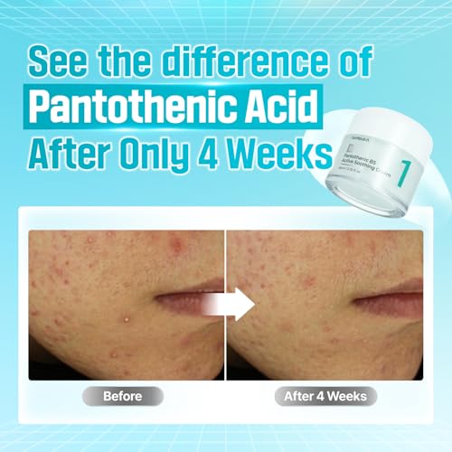 numbuzin No.1 Cream | Pantothenic B5 Active Soothing Cream | Lightweight Hydrating Moisturizer, Pantothenic Acid, Niacinamide | Excess Oil Control, Soothes Acne | Non-Comedogenic | 2.70 fl. oz.