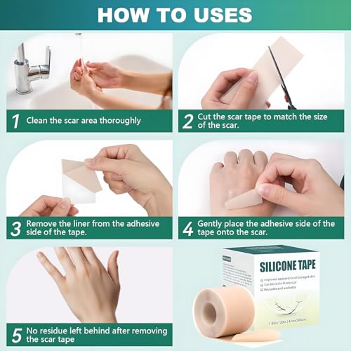Silicone Scar Sheets (1.6" x 120" Roll-3M), Silicone Scar Tape for Scar Removal Treatment, Silicone Scar Removal Strips for Surgical, C-Section, Tummy Tuck, Keloid Bump Removal