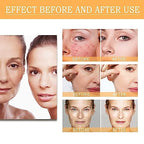 Ordinary Glycolic Acid Toner, Glycolic Acid 7% Toning Resurfacing Solution Wrinkle Exfoliating Serum (8.12 fl.oz)