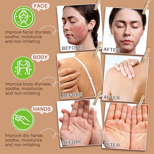Beef Tallow for Skin,Beef Tallow for Face,Beef Tallow and Honey Balm,Grass Fed Whipped Tallow Honey Balm,Natural Moisturizer Hydrates,Deeply Nourishes the Skin, Enhances Natural Radiance