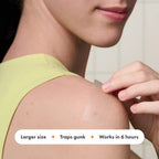 Mighty Patch Surface Large Pimple Patches for Face from Hero Cosmetics, Acne Spot for Body, Cheek, Forehead, and Chin, Pimple Stickers, Hydrocolloid Covers, Vegan-friendly, 10 Count