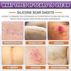 Silicone Scar Sheets,Silicone Scar Tape,Scar Tape for Surgical,C-Section,Tummy Tuck,Keloid(1.6"X 120" Roll-3M) Keloid Bump Removal