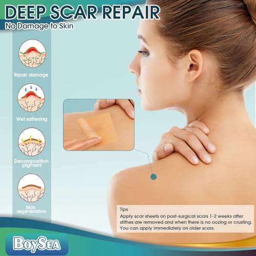 Silicone Scar Sheets (1.6" x 120") Clear Silicone Scar Tape - Scars Removal Treatment - Reusable Scar Strips for Keloid, C-Section, Burn, Surgical Scars