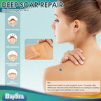 Silicone Scar Sheets (1.6" x 120") Clear Silicone Scar Tape - Scars Removal Treatment - Reusable Scar Strips for Keloid, C-Section, Burn, Surgical Scars