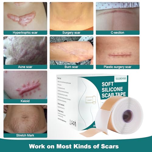Silicone Scar Sheets (1.6"x 158" Roll-4M), Silicone Scar Tape for Scar Removal Treatment, Reusable Silicone Scar Strips for C-Section, Keloid, Burn, Acne, Surgical Scars