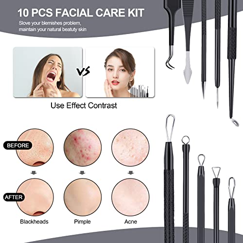 MENOLY Pimple Popper Tool Kit 10 Pcs Blackhead Remover Tool Zit Popper for Blemish, Pimple Comedone Extractor Acne Tool for Blackheads, Acnes, Whiteheads Nose Face Tools with Leather Bag