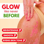 Bikini Area Exfoliator, 2% Kojic Acid Vitamin C & 7% AHA/BHA Even Skin Tone & Ingrown Hair - Underarm Scrub - Radian, Smoothe & Soften Body Scrub