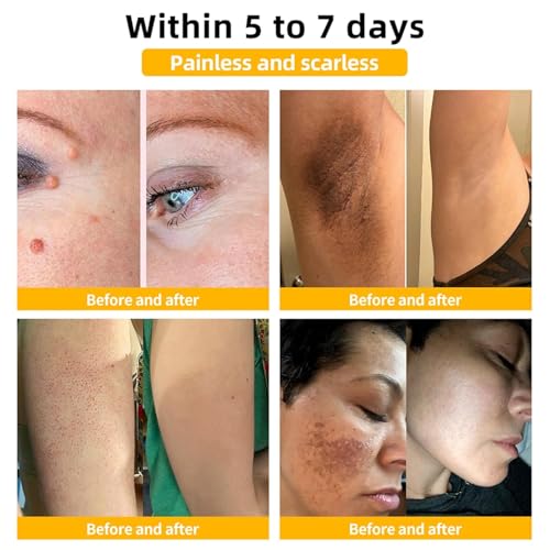 2PCS Bee Venom Cream, Bee Venom Skin Treatment Cream for Women, Bee Venom for All Skin Types