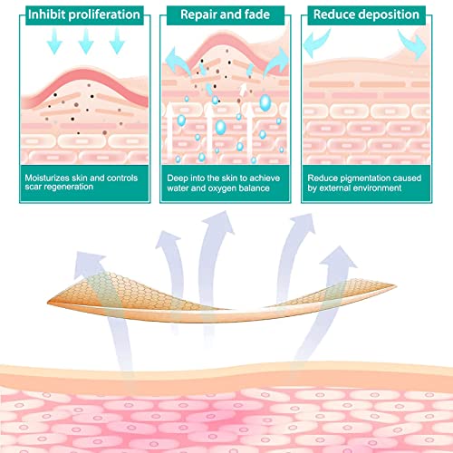 Silicone Scar Sheets, Tape, Strips, 16 Pcs 5.9"x1.6", Healing Keloid, C-Section, Tummy Tuck - As Surgical Cream, Gel, Patch, Bandage, Pad - Surgery Scars Treatment, Scar Remover.