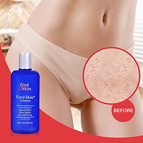 Tend Skin Razor Bump Solution, 4 ounce, Post Shaving & Waxing, for women & men