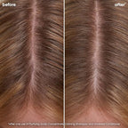 Biolage Scalp Sync Calming Shampoo - Calms & Hydrates Dry or Irritated Scalp, Paraben & Silicone Free, Vegan & Cruelty Free