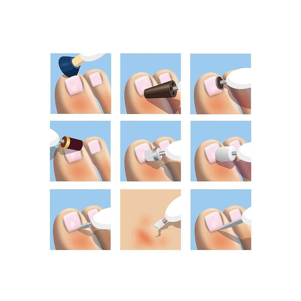 Coopers of Stortford - Long-Reach Nail Trimmer with Motorised with Extra-Long Shaft & 10 Interchangeable Precision Heads - Remove Calluses, File, Shape, and More - Easy Foot and Nail Care at Home