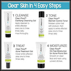 Clear Skin 4-Step Acne Treatment Set – Cleanser, Toner, Acne Gel & Oil-Free Moisturizer for Oily and Acne-Prone Skin