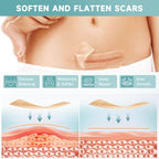 Losveo Silicone Scar Sheets for Face Wrinkles, Medical Grade Silicone Scar Sheets(1.6”x 120” Roll-3M) for Surgical Scars, C-Section, Burn, and Acne Scars- Reusable Scar Removal Strips