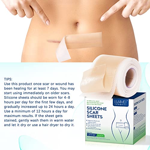 Silicone Scar Sheets (1.6”x 130”, 3.3M), Professional Silicone Scar Tape, Silicone Scar Strips, Reusable Scar Removal Sheets for Surgical Scars, C-Section, Surgery, Burn, Keloid, Acne