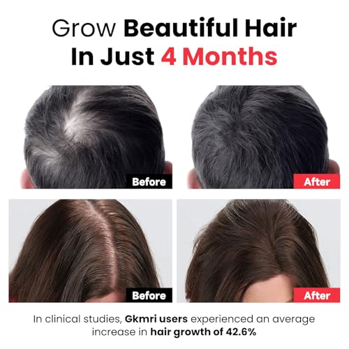 Laser Therapy Hair Growth Comb,Red Light Therapy for Hair Growth,LED Electric Scalp Massager,Red Light Hair Brush,Suitable for Men and Women with Thinning Hair and Hair loss.