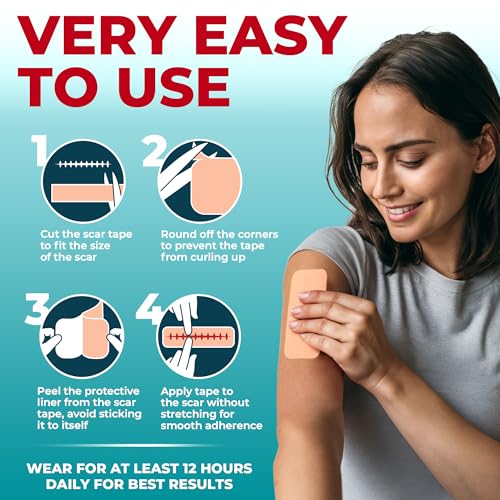 Medical Grade Silicone Scar Tape - 1.6”x150” - Visible Difference on Keloid & С-Section - Reusable Silicone Scar Sheets - Easy to Use