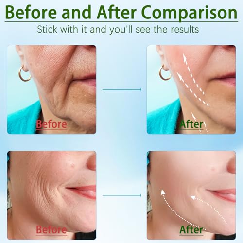 JURP 7-in-1 Red-Light-Therapy-for-Face and Neck, Face Neck Massager for Daily Skin Care Routine, Skin Care Tool