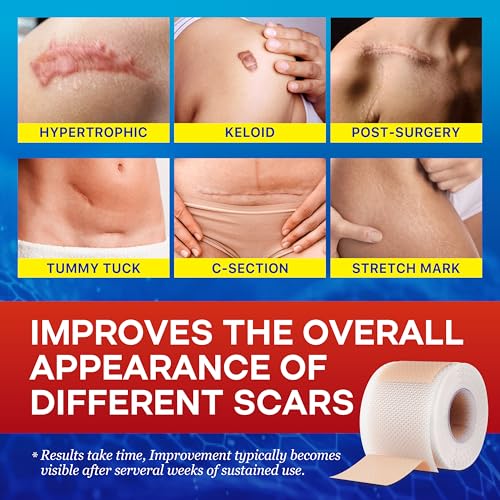 1.6"x 60" Medical Silicone Scar tape for Scars: Medical Grade Scar Sheets Reduces the Appearance of Scars from surgical Acne Stitches Burns More