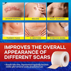 1.6"x 60" Medical Silicone Scar tape for Scars: Medical Grade Scar Sheets Reduces the Appearance of Scars from surgical Acne Stitches Burns More