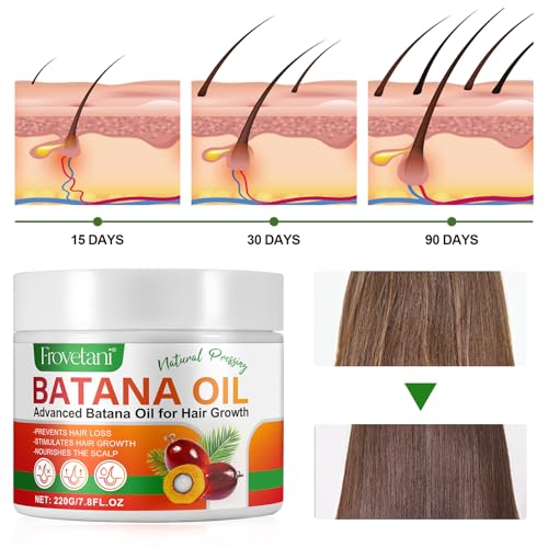 Frovetani Batana Oil from Honduras for Hair Growth, 100% Organic Raw , Promotes Hair Thickness, Healthier & Strengthening, Prevents Hair Loss 7.8FL.OZ