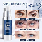 Enaskin Naturals Instant Anti Wrinkle Eye Cream: Rapid Temporay Eye Tightener for Dark Circles, Fine Lines and Puffiness in 60s, Anti Aging Under Eye Cream for Fine Lines and Eye Bags